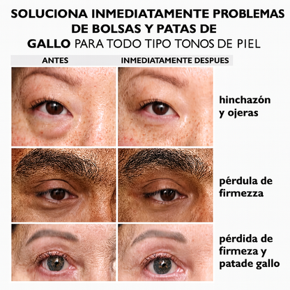 Tensador Facial Instantáneo